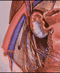 L'embolisation des art�res ut�rines 